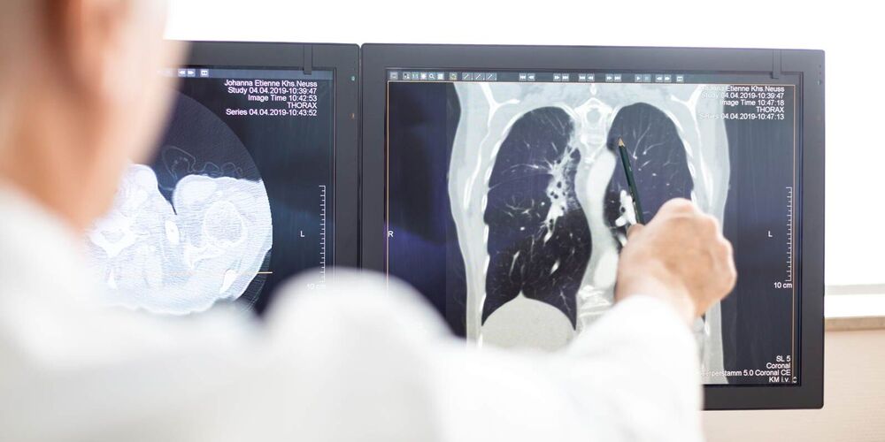 Aufnahme aus der Radiologie der Computer. Ein Arzt zeigt mit einem Stift etwas auf dem Bild. 
