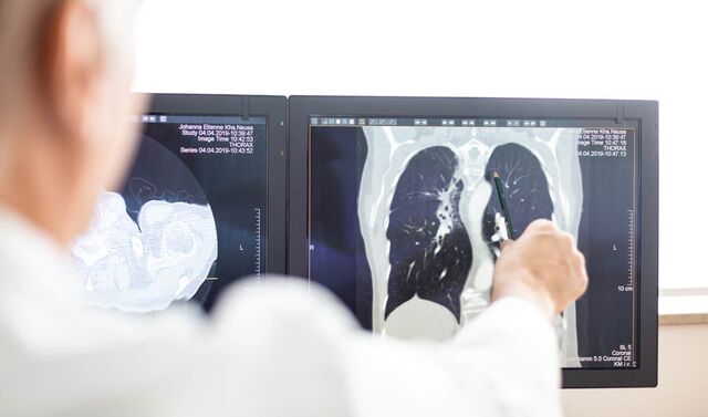 Aufnahme aus der Radiologie der Computer. Ein Arzt zeigt mit einem Stift etwas auf dem Bild. 