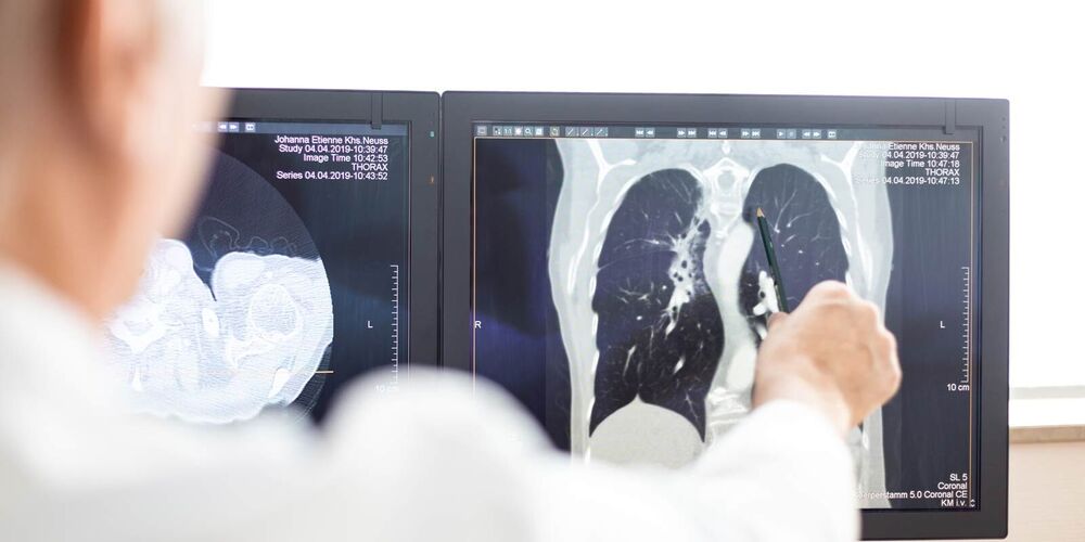 Aufnahme aus der Radiologie der Computer. Ein Arzt zeigt mit einem Stift etwas auf dem Bild. 