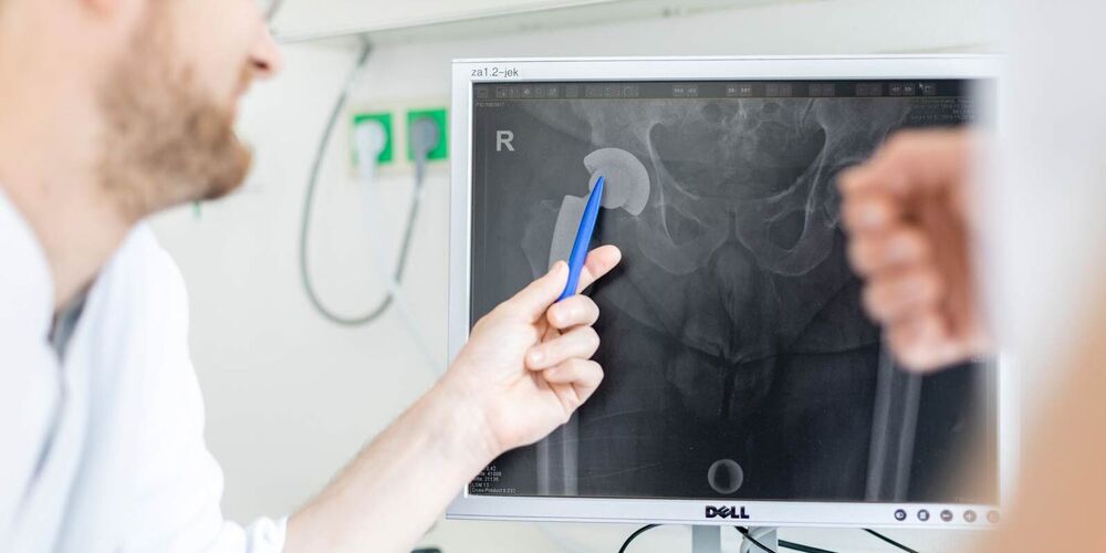 Bild eines Beckens auf einem Computerbildschirm. Ein Arzt zeigt mit einem Stift etwas auf diesem. 