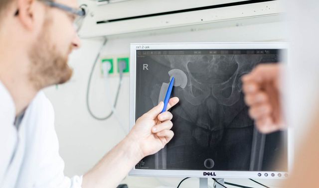 Bild eines Beckens auf einem Computerbildschirm. Ein Arzt zeigt mit einem Stift etwas auf diesem. 