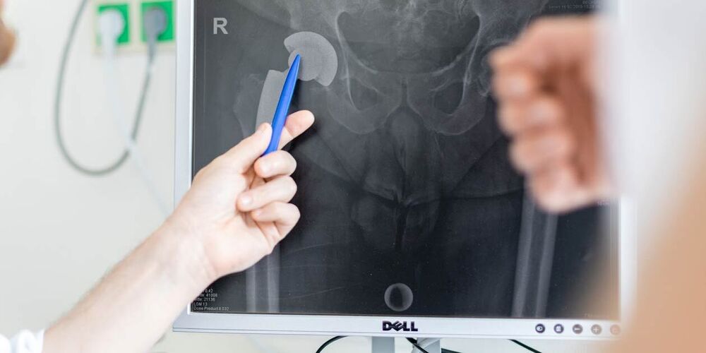 Bild eines Beckens auf einem Computerbildschirm. Ein Arzt zeigt mit einem Stift etwas auf diesem. 